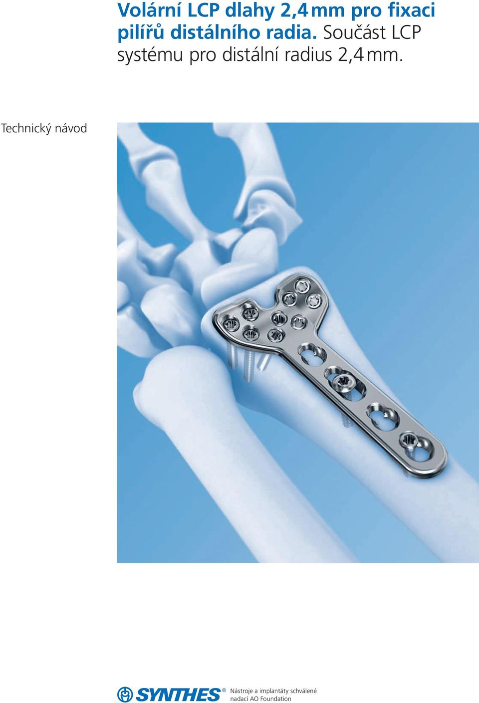 Volární LCP dlahy 2,4 mm pro fixaci pilířů distálního radia. Součást LCP  systému pro distální radius 2,4 mm. - PDF Stažení zdarma