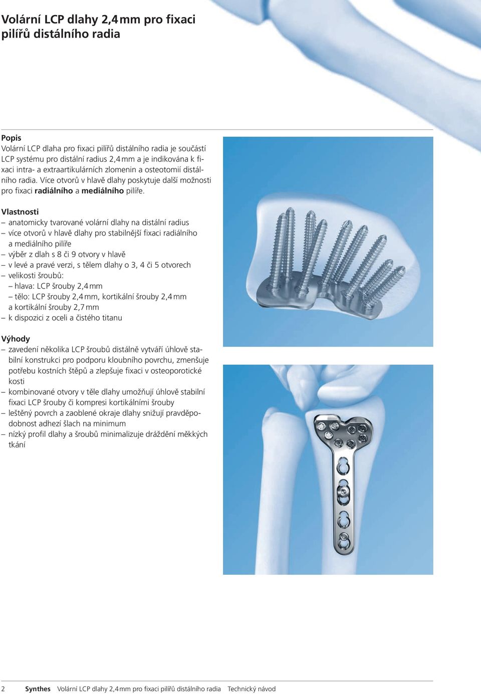 Vlastnosti anatomicky tvarované volární dlahy na distální radius více otvorů v hlavě dlahy pro stabilnější fixaci radiálního a mediálního pilíře výběr z dlah s 8 či 9 otvory v hlavě v levé a pravé