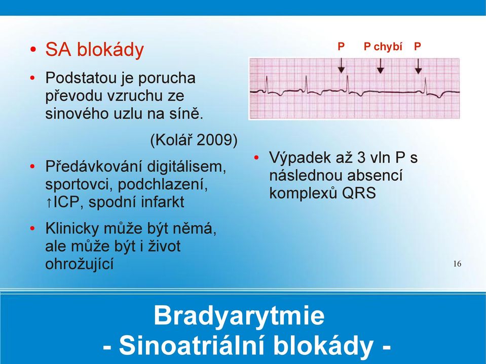 spodní infarkt Výpadek až 3 vln P s následnou absencí komplexů QRS Klinicky