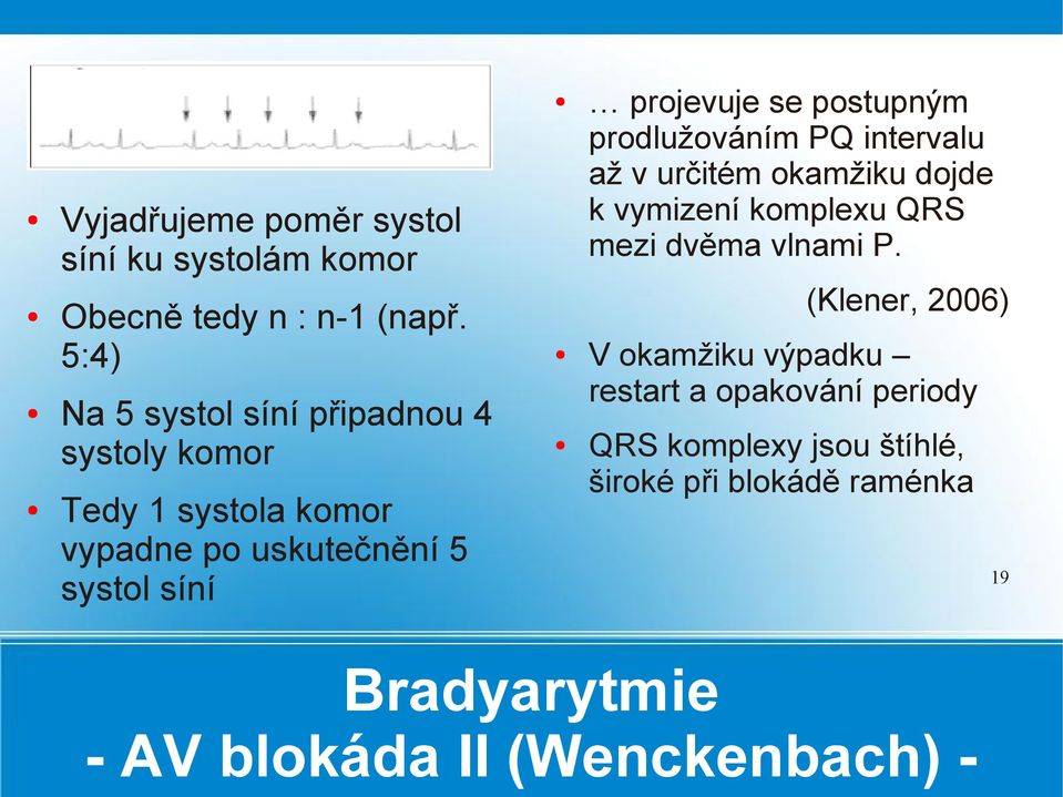 se postupným prodlužováním PQ intervalu až v určitém okamžiku dojde k vymizení komplexu QRS mezi dvěma vlnami P.