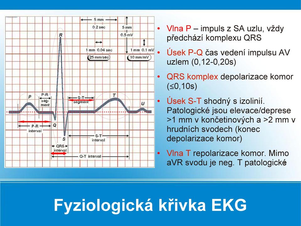 Patologické jsou elevace/deprese >1 mm v končetinových a >2 mm v hrudních svodech (konec