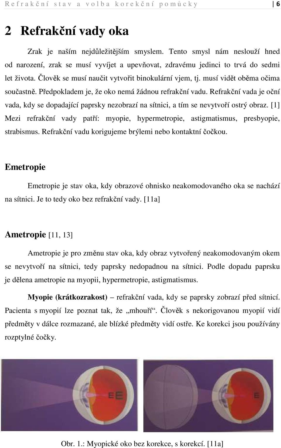 musí vidět oběma očima součastně. Předpokladem je, že oko nemá žádnou refrakční vadu. Refrakční vada je oční vada, kdy se dopadající paprsky nezobrazí na sítnici, a tím se nevytvoří ostrý obraz.