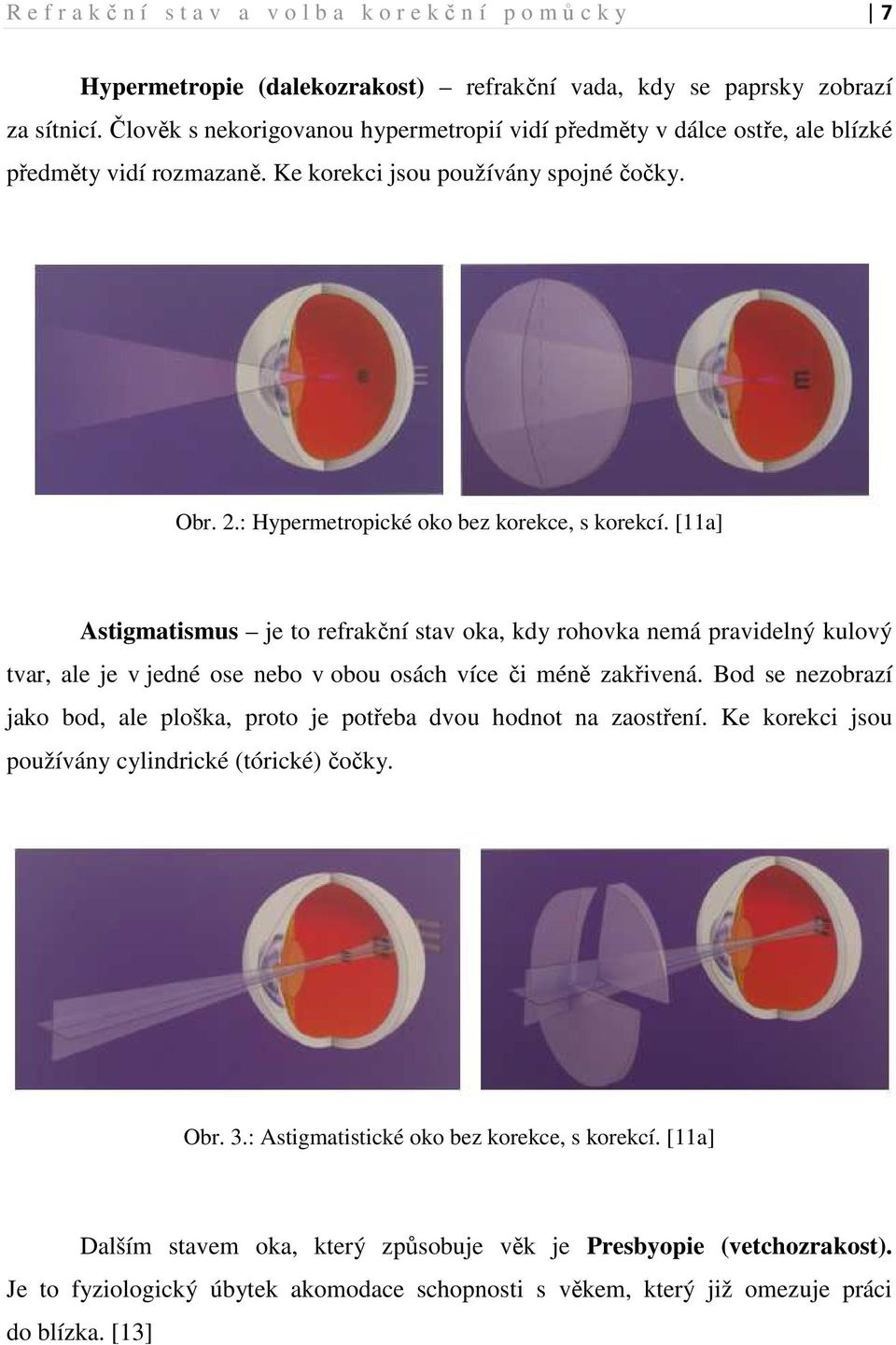 [11a] Astigmatismus je to refrakční stav oka, kdy rohovka nemá pravidelný kulový tvar, ale je v jedné ose nebo v obou osách více či méně zakřivená.