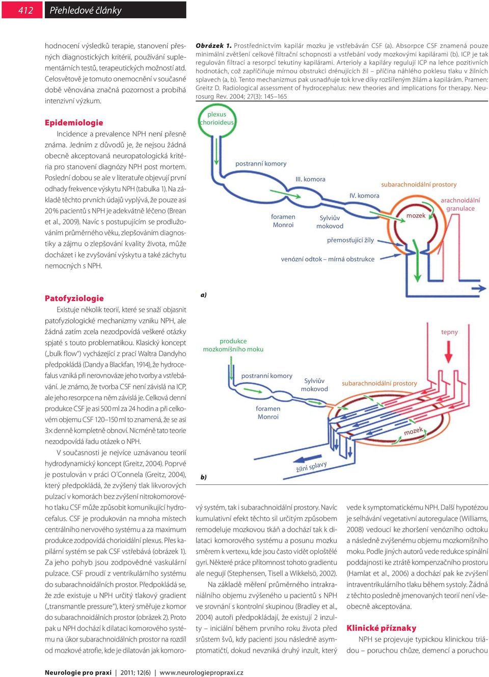 Jedním z důvodů je, že nejsou žádná obecně akceptovaná neuropatologická kritéria pro stanovení diagnózy NPH post mortem.