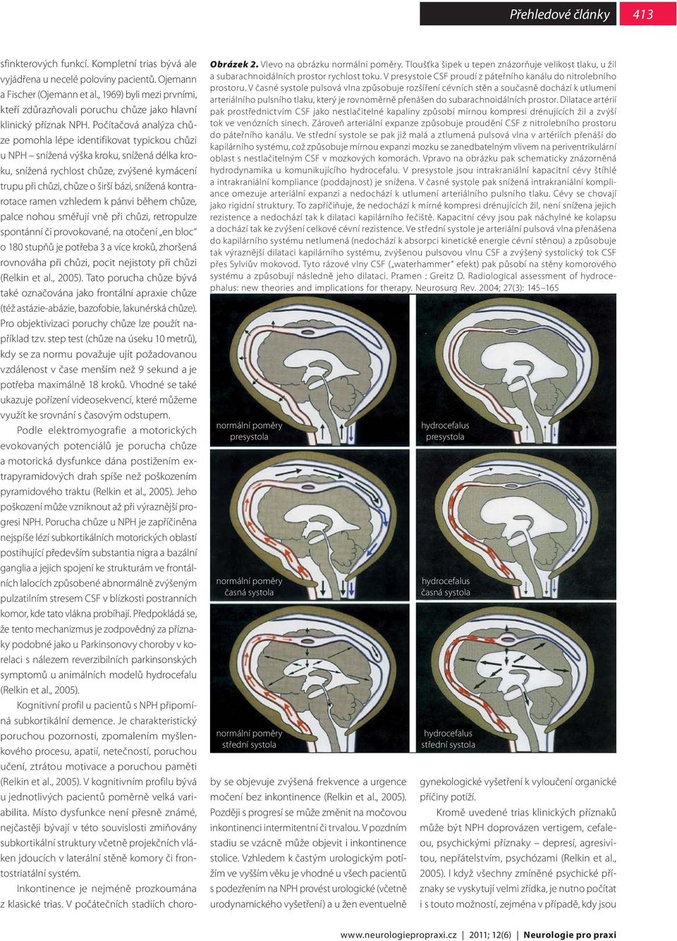 V časné systole pulsová vlna způsobuje rozšíření cévních stěn a současně dochází k utlumení arteriálního pulsního tlaku, který je rovnoměrně přenášen do subarachnoidálních prostor.