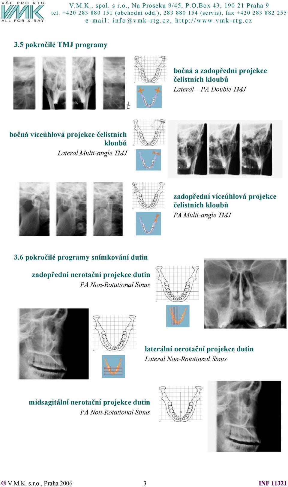 6 pokročilé programy snímkování dutin zadopřední nerotační projekce dutin PA Non-Rotational Sinus laterální nerotační