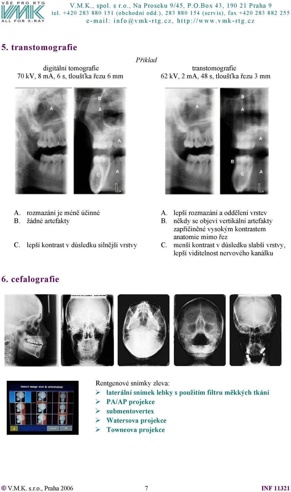 někdy se objeví vertikální artefakty zapříčiněné vysokým kontrastem anatomie mimo řez C. lepší kontrast v důsledku silnější vrstvy C.
