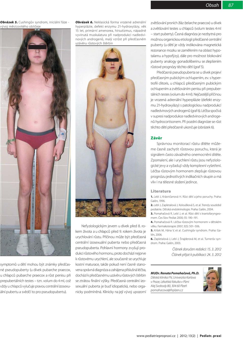 vzrůst při předčasném uzávěru růstových štěrbin zvětšování prsních žláz (telarche praecox) u dívek a zvětšování testes u chlapců (volum testes 4 ml start puberty).