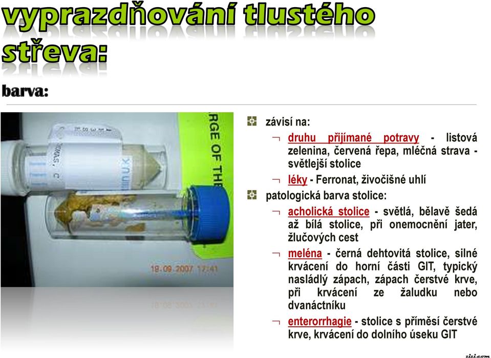 jater, žlučových cest meléna - černá dehtovitá stolice, silné krvácení do horní části GIT, typický nasládlý zápach, zápach