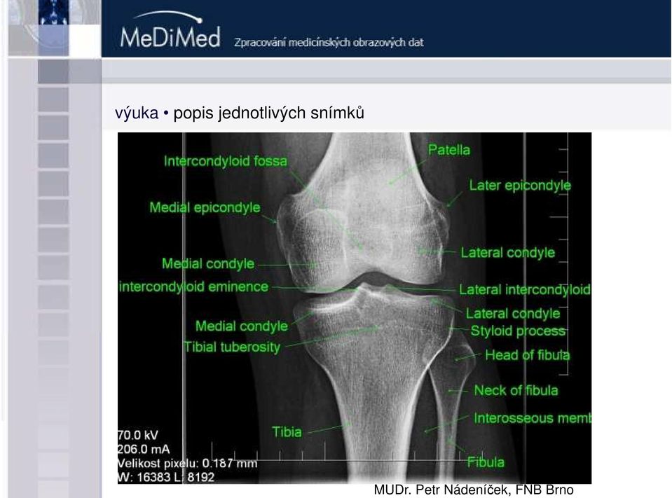 snímků MUDr.