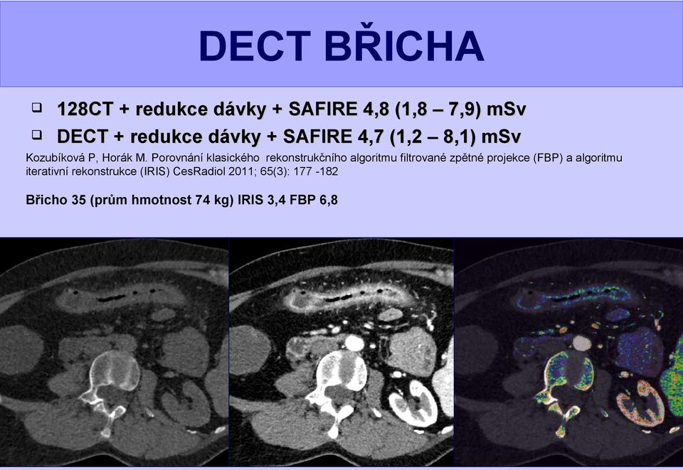Porovnání klasického rekonstrukčního algoritmu filtrované zpětné projekce (FBP) a