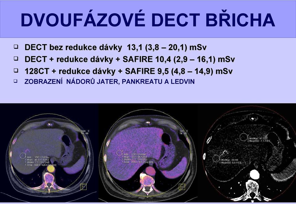 (2,9 16,1) msv 128CT + redukce dávky + SAFIRE 9,5