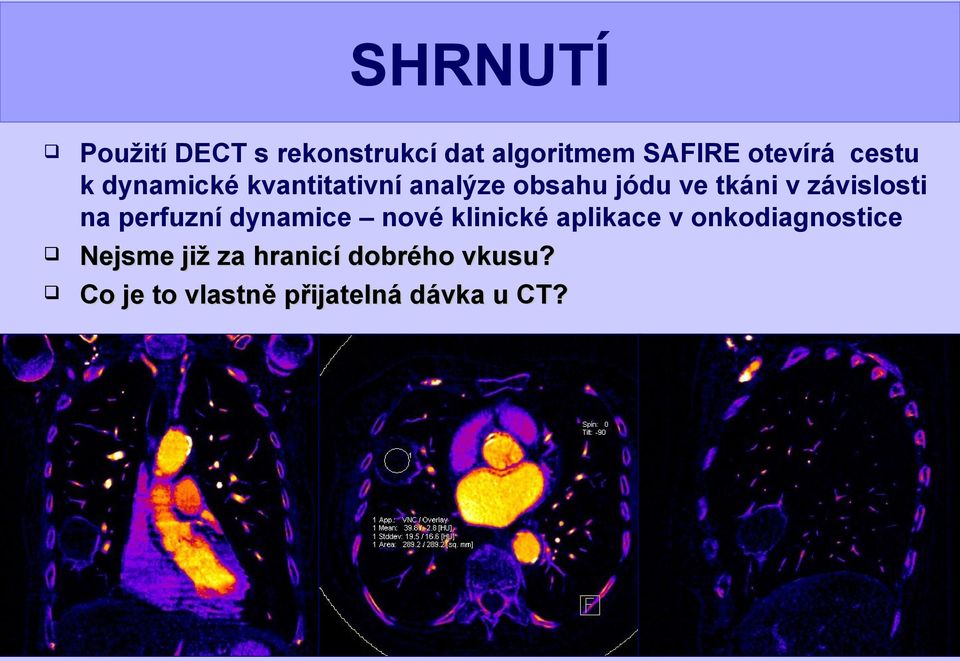 závislosti na perfuzní dynamice nové klinické aplikace v