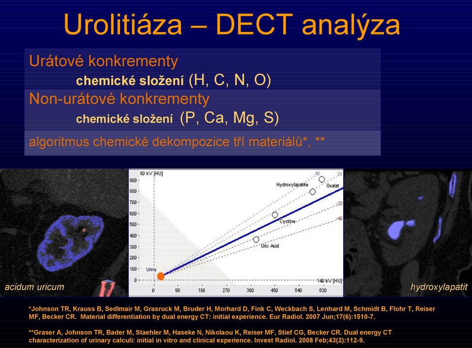 MF, Becker CR. Material differentiation by dual energy CT: initial experience. Eur Radiol. 2007 Jun;17(6):1510-7.