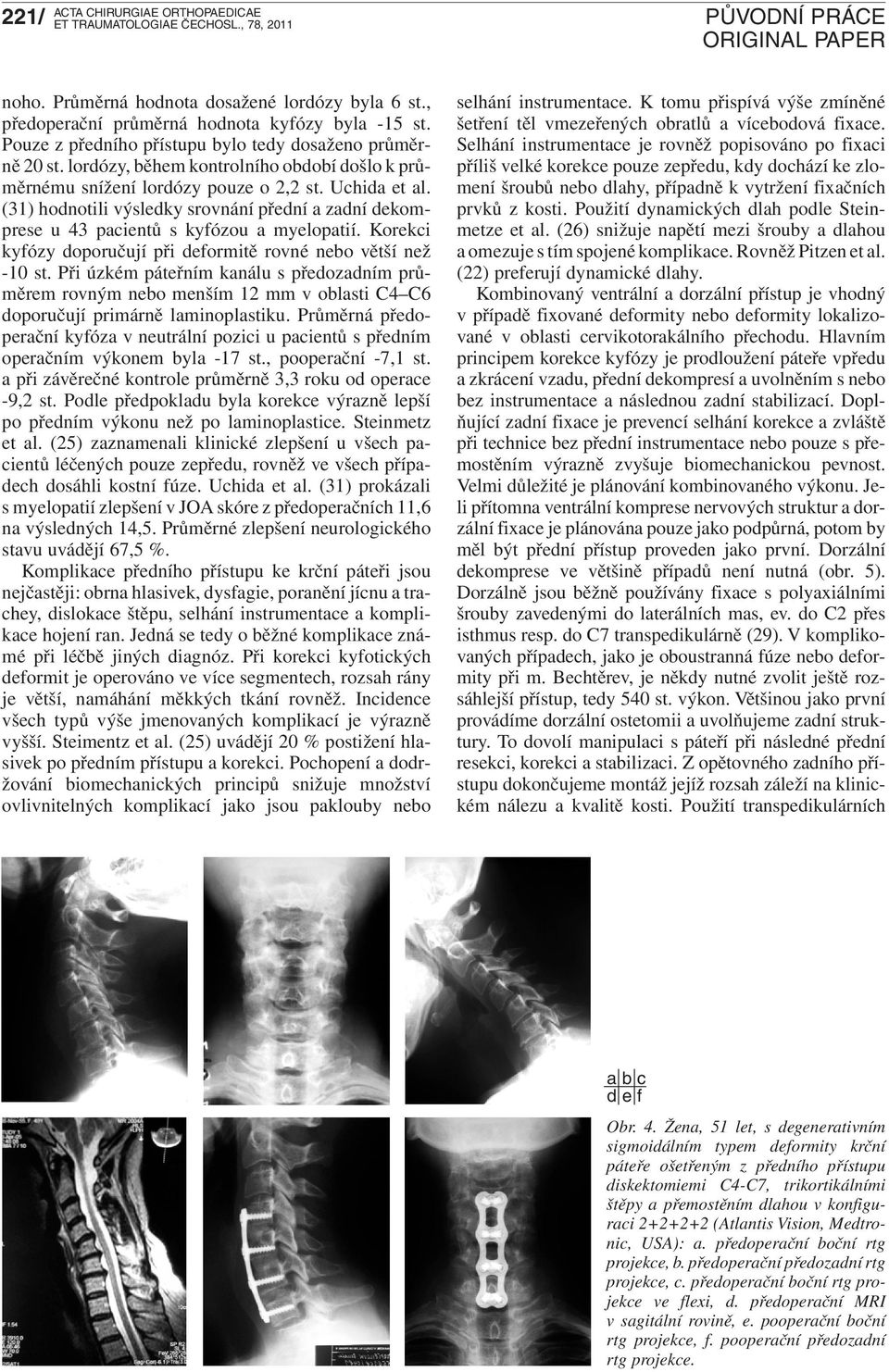 Korekci kyfózy doporučují při deformitě rovné nebo větší než -10 st. Při úzkém páteřním kanálu s předozadním průměrem rovným nebo menším 12 mm v oblasti C4 C6 doporučují primárně laminoplastiku.