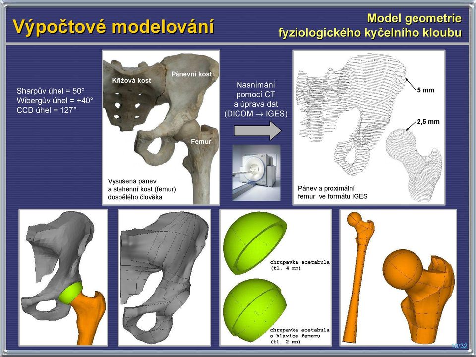 = 50 Wibergův úhel = +40 CCD úhel = 127 5 mm 2,5 mm Femur Vysušená pánev a