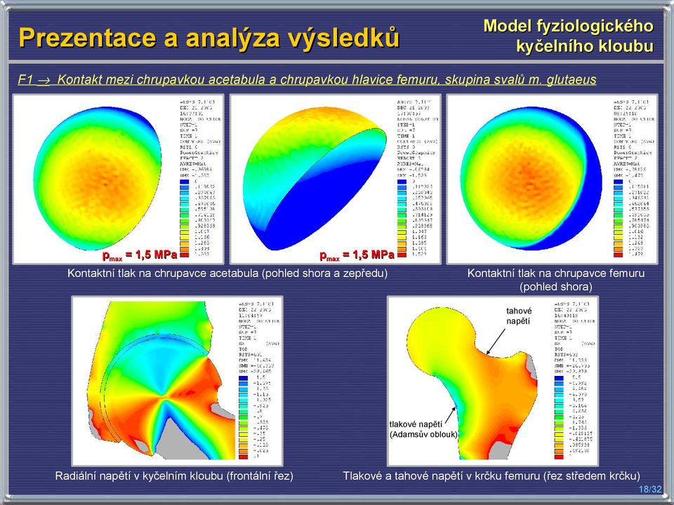 glutaeus pmax = 1,5 MPa pmax = 1,5 MPa Kontaktní tlak na chrupavce femuru (pohled shora) Kontaktní tlak na