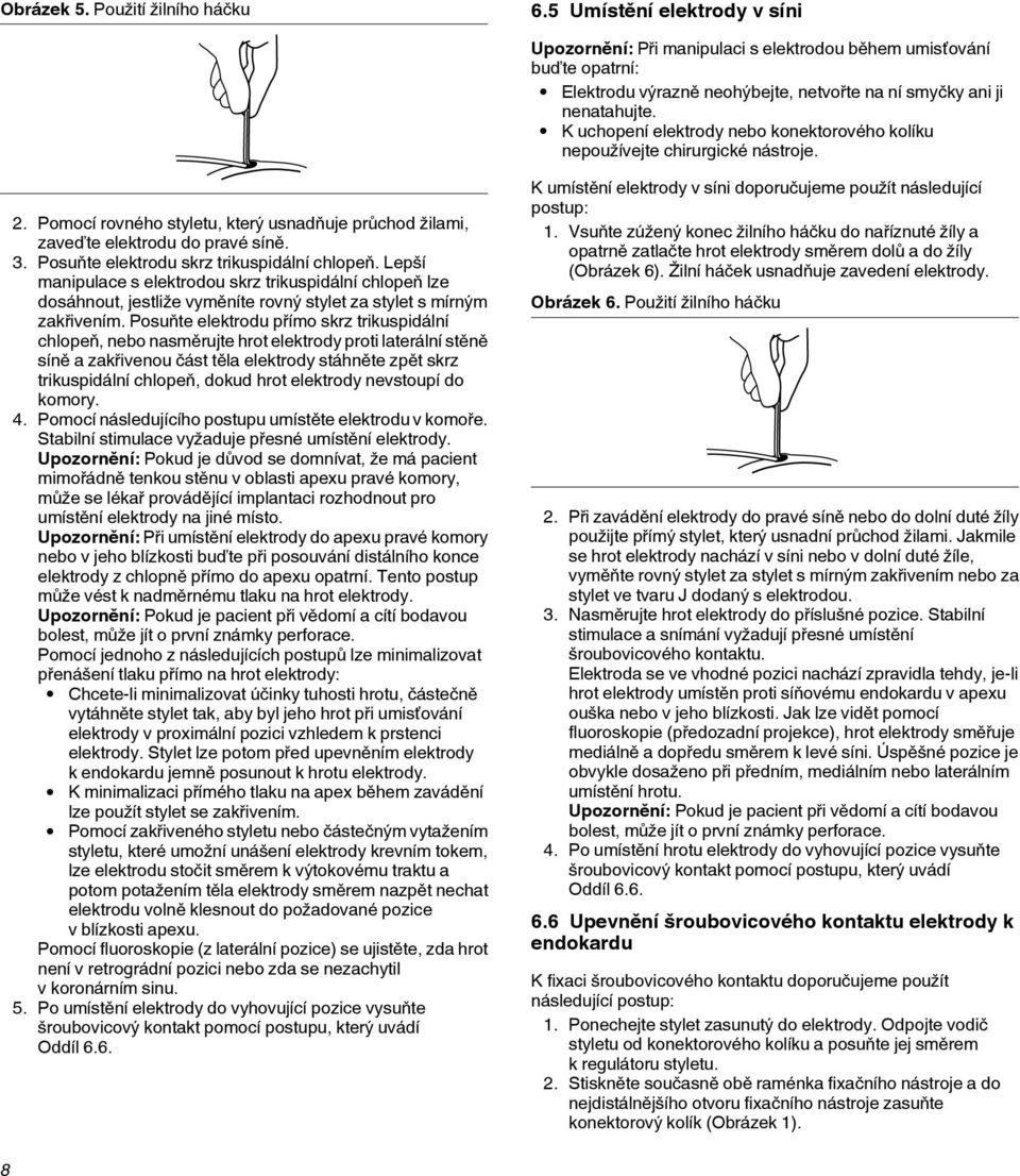 K uchopení elektrody nebo konektorového kolíku nepoužívejte chirurgické nástroje. 2. Pomocí rovného styletu, který usnadňuje průchod žilami, zaveďte elektrodu do pravé síně. 3.