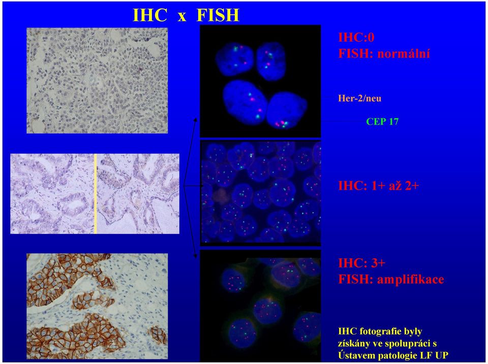 FISH: amplifikace IHC fotografie byly