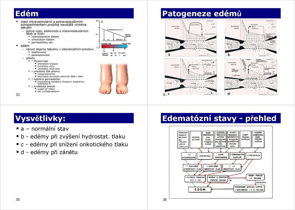 obstrukce onkotický tlak plazmy hypoproteinemie akumulace osmoticky aktivních látek v tkáni kapilární permeabilita prozánětlivé mediátory (histamin, bradykinin, substance P) lymfatická drenáž