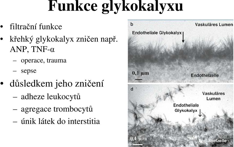 ANP, TNF-α operace, trauma sepse důsledkem