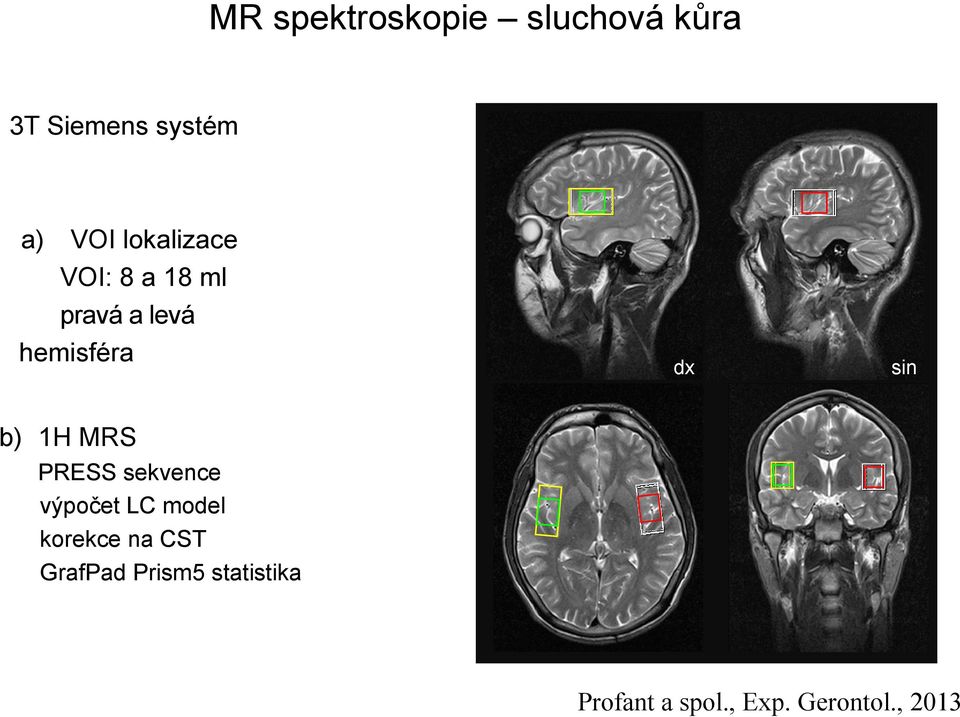 b) 1H MRS PRESS sekvence výpočet LC model korekce na CST
