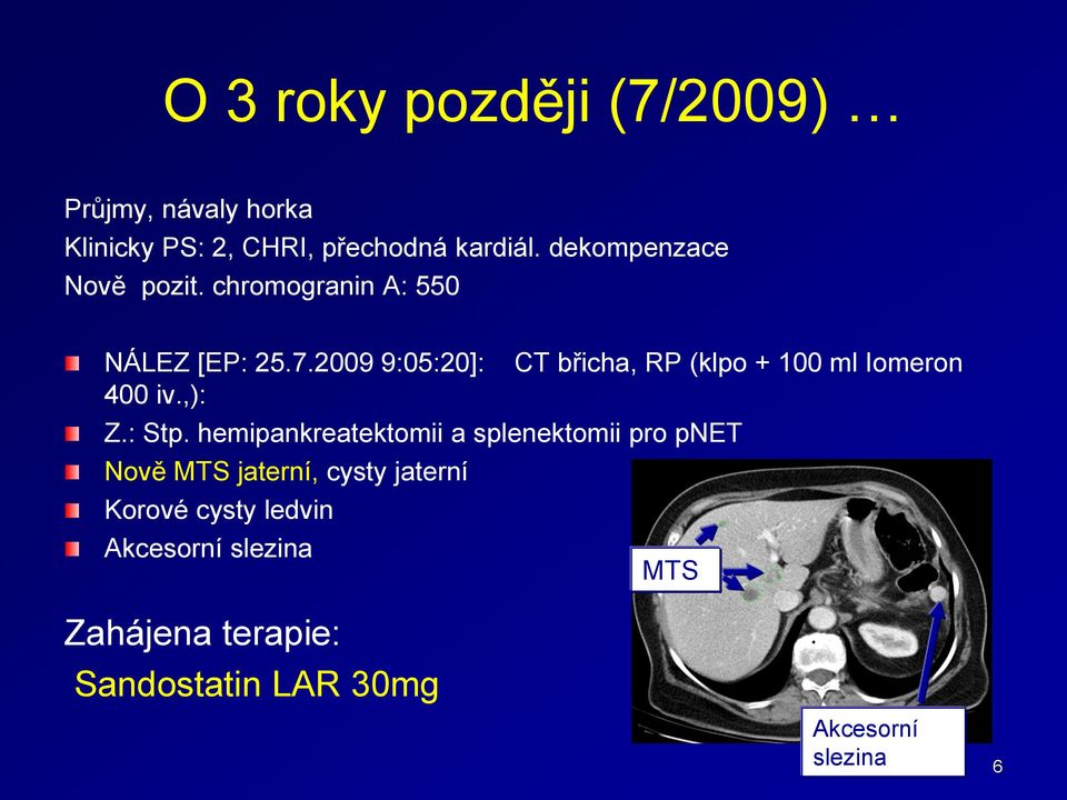 2009 9:05:20]: CT břicha, RP (klpo + 100 ml Iomeron 400 iv.,): Z.: Stp.