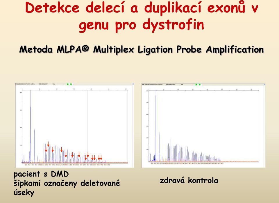 Ligation Probe Amplification pacient s