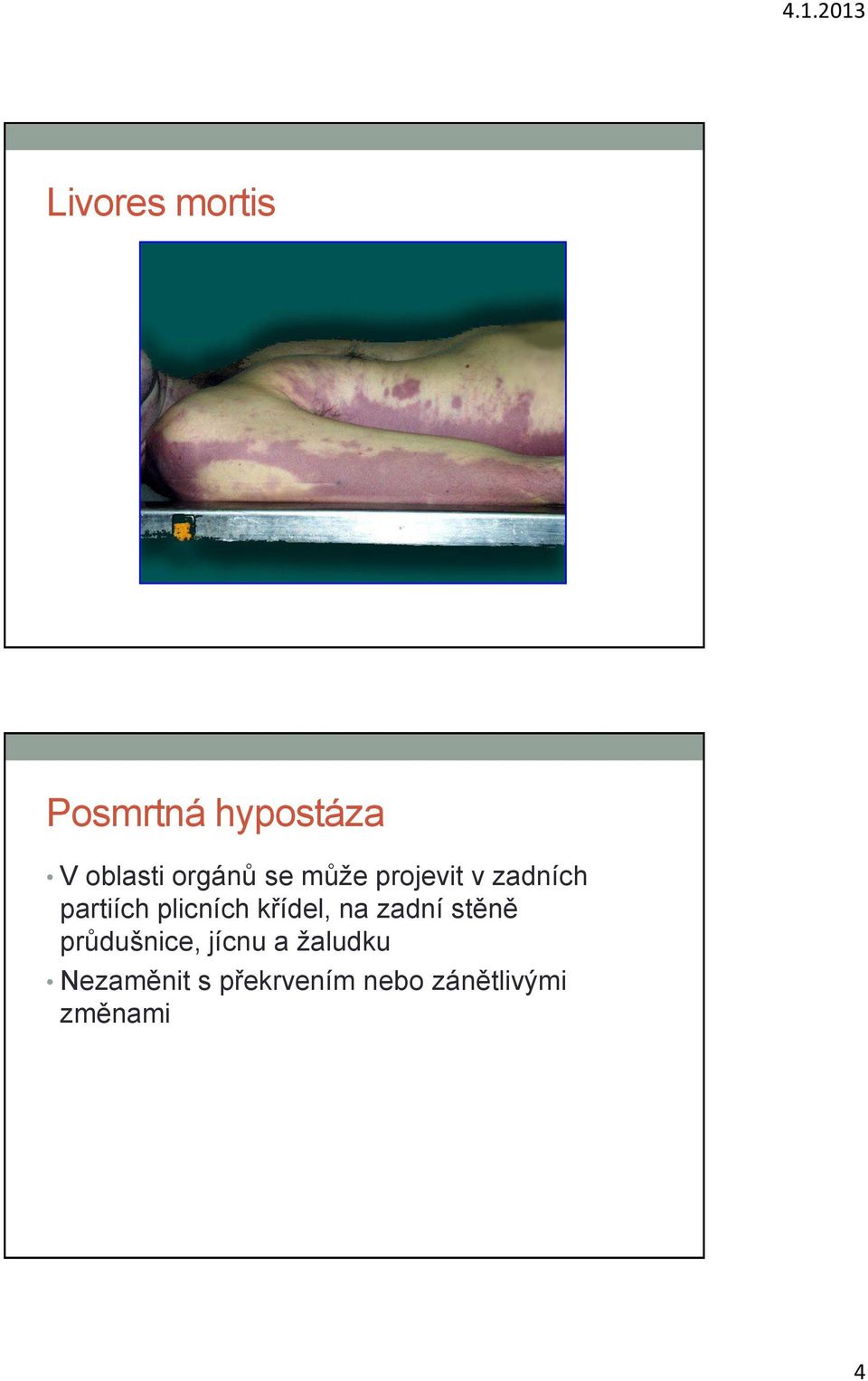 plicních křídel, na zadní stěně průdušnice,