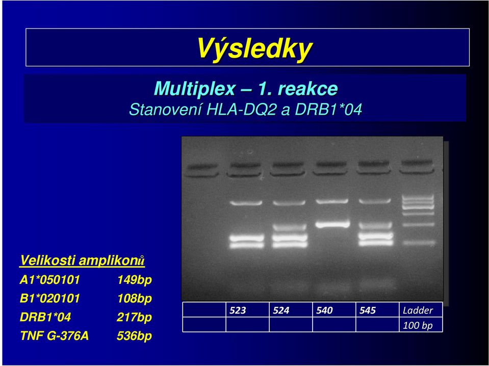 Velikosti amplikonů A1*050101 149bp