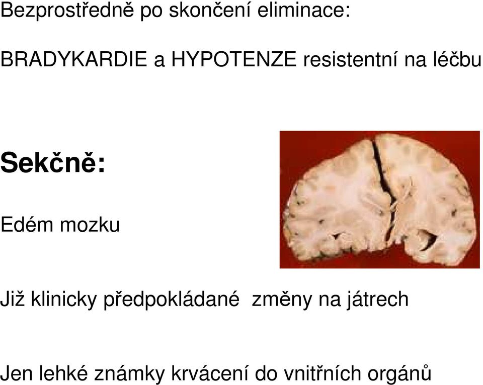 Sekčně: Edém mozku Již klinicky předpokládané