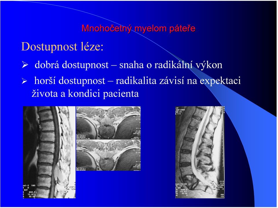 radikální výkon horší dostupnost