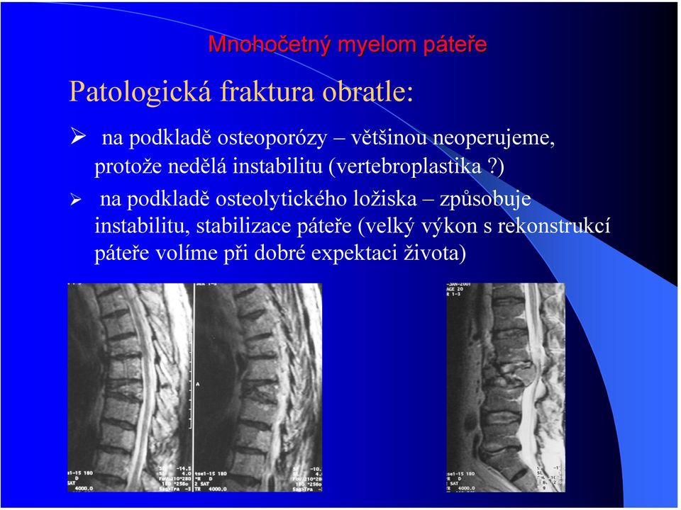 ) na podkladě osteolytického ložiska způsobuje instabilitu,