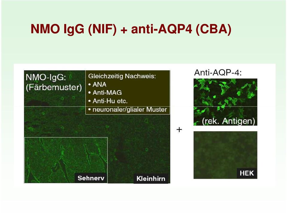 anti-aqp4