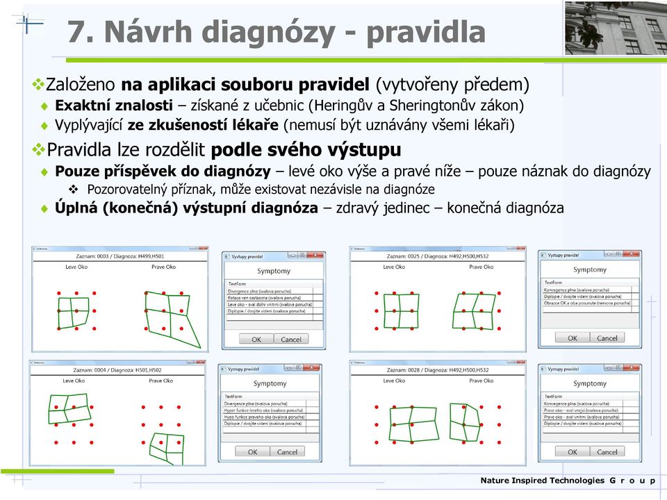 lze rozdělit podle svého výstupu Pouze příspěvek do diagnózy levé oko výše a pravé níže pouze náznak do diagnózy