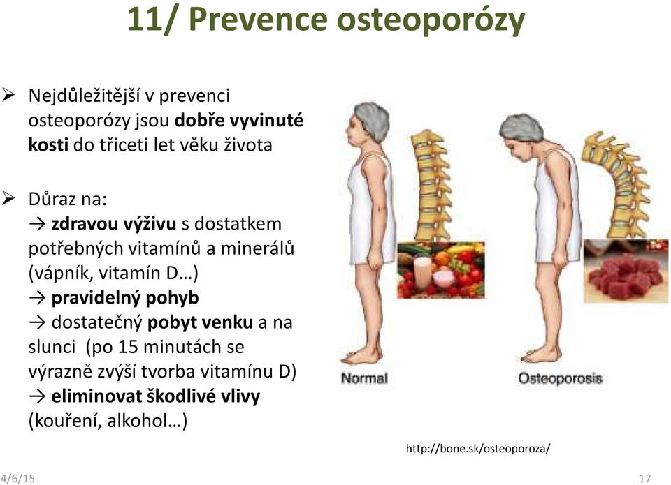 (vápník, vitamín D ) pravidelný pohyb dostatečný pobyt venku a na slunci (po 15minutách se