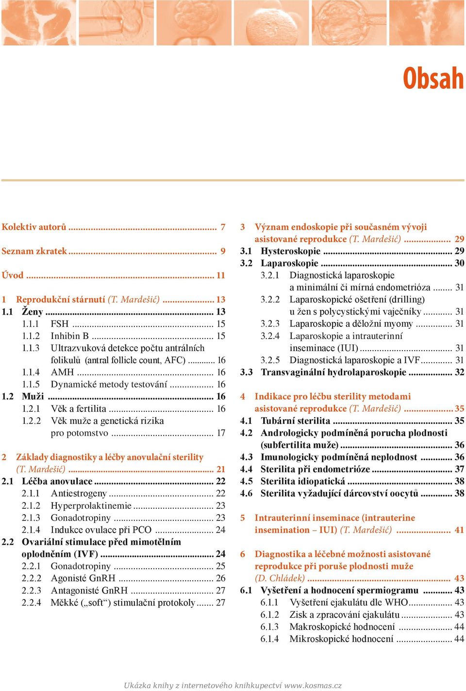 .. 17 2 Základy diagnostiky a léčby anovulační sterility (T. Mardešić)... 21 2.1 Léčba anovulace... 22 2.1.1 Antiestrogeny... 22 2.1.2 Hyperprolaktinemie... 23 2.1.3 Gonadotropiny... 23 2.1.4 Indukce ovulace při PCO.
