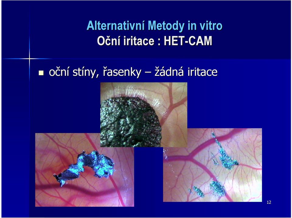 : HET-CAM oční stíny,