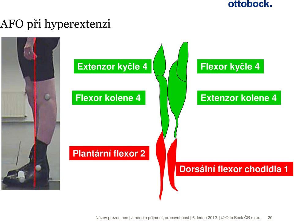 kolene 4 Extenzor kolene 4