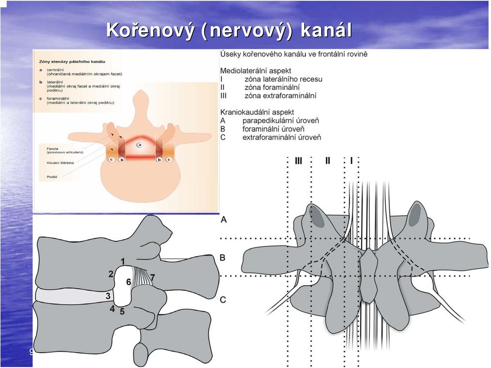 kanál