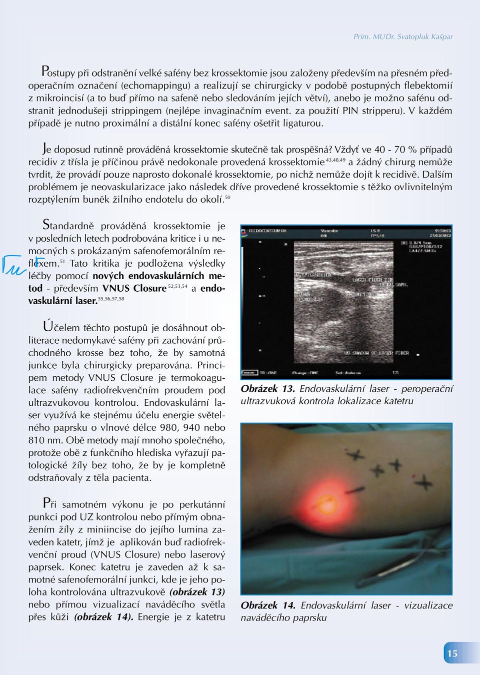 flebektomií z mikroincisí (a to buď přímo na safeně nebo sledováním jejích větví), anebo je možno safénu odstranit jednodušeji strippingem (nejlépe invaginačním event. za použití PIN stripperu).