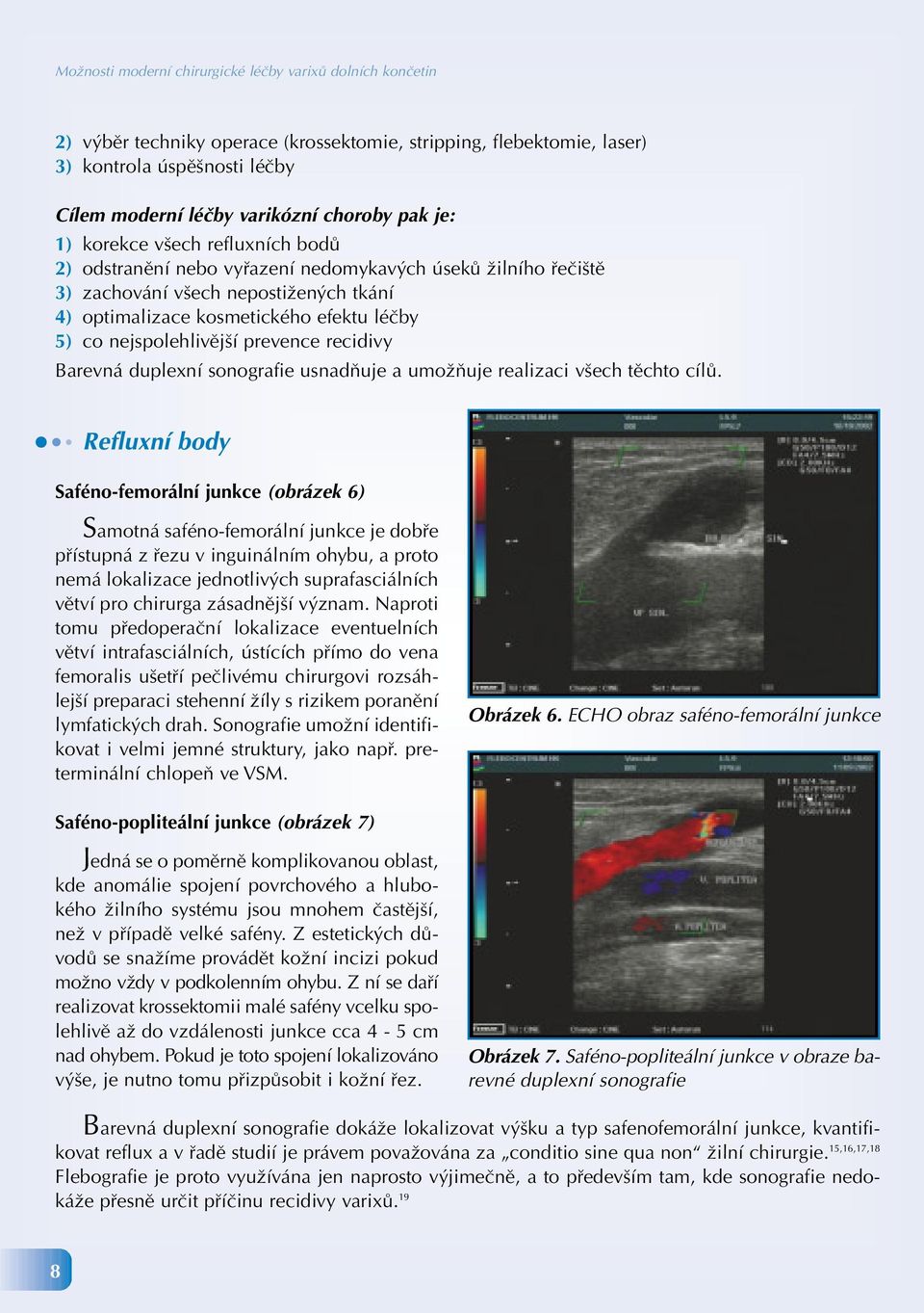 nejspolehlivější prevence recidivy Barevná duplexní sonografie usnadňuje a umožňuje realizaci všech těchto cílů.