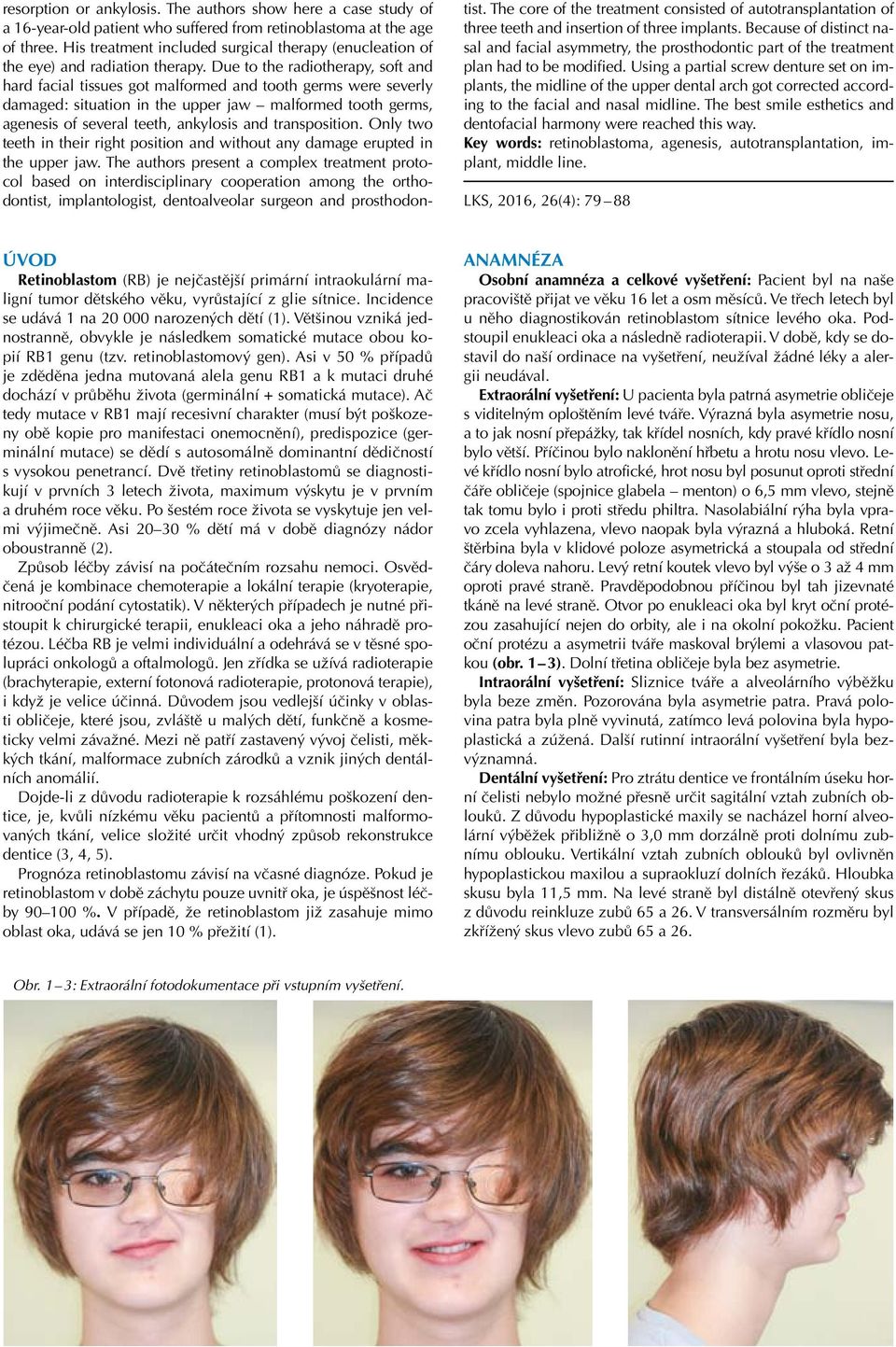 Due to the radiotherapy, soft and hard facial tissues got malformed and tooth germs were severly damaged: situation in the upper jaw malformed tooth germs, agenesis of several teeth, ankylosis and