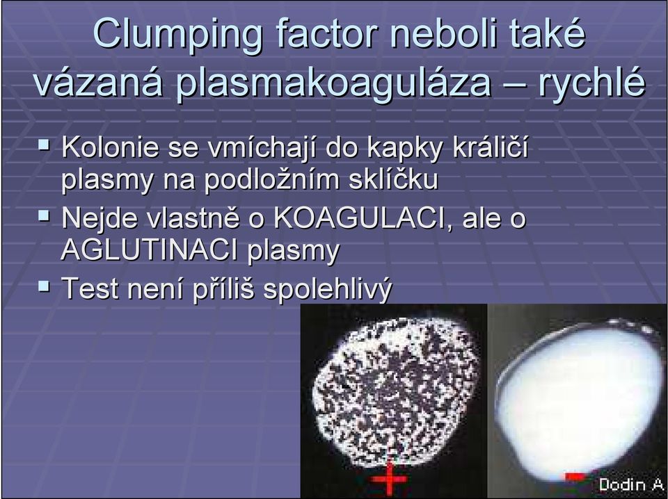 plasmy na podložním m sklíčku ku Nejde vlastně o