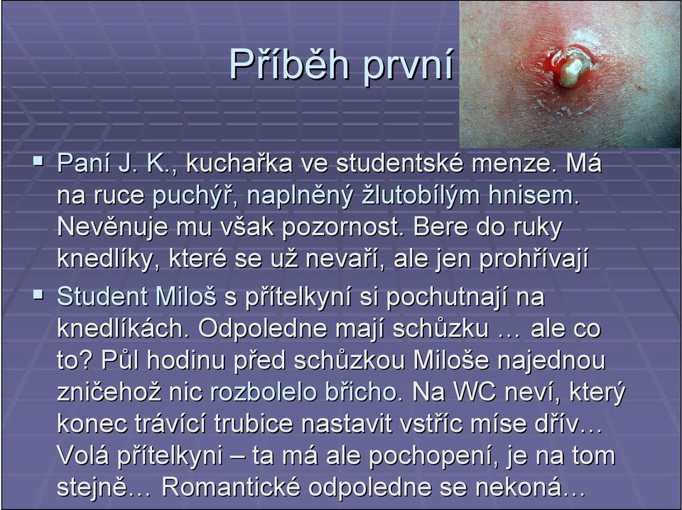 Bere do ruky knedlíky, ky, které se užu nevaří,, ale jen prohřívaj vají Student Miloš s přítelkynp telkyní si pochutnají na knedlíkách.