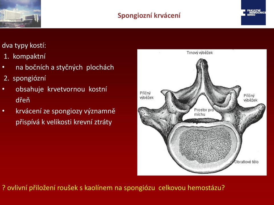 spongiózní obsahuje krvetvornou kostní dřeň krvácení ze spongiozy