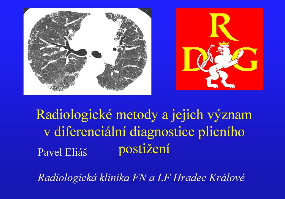 plicního Pavel Eliáš postižení