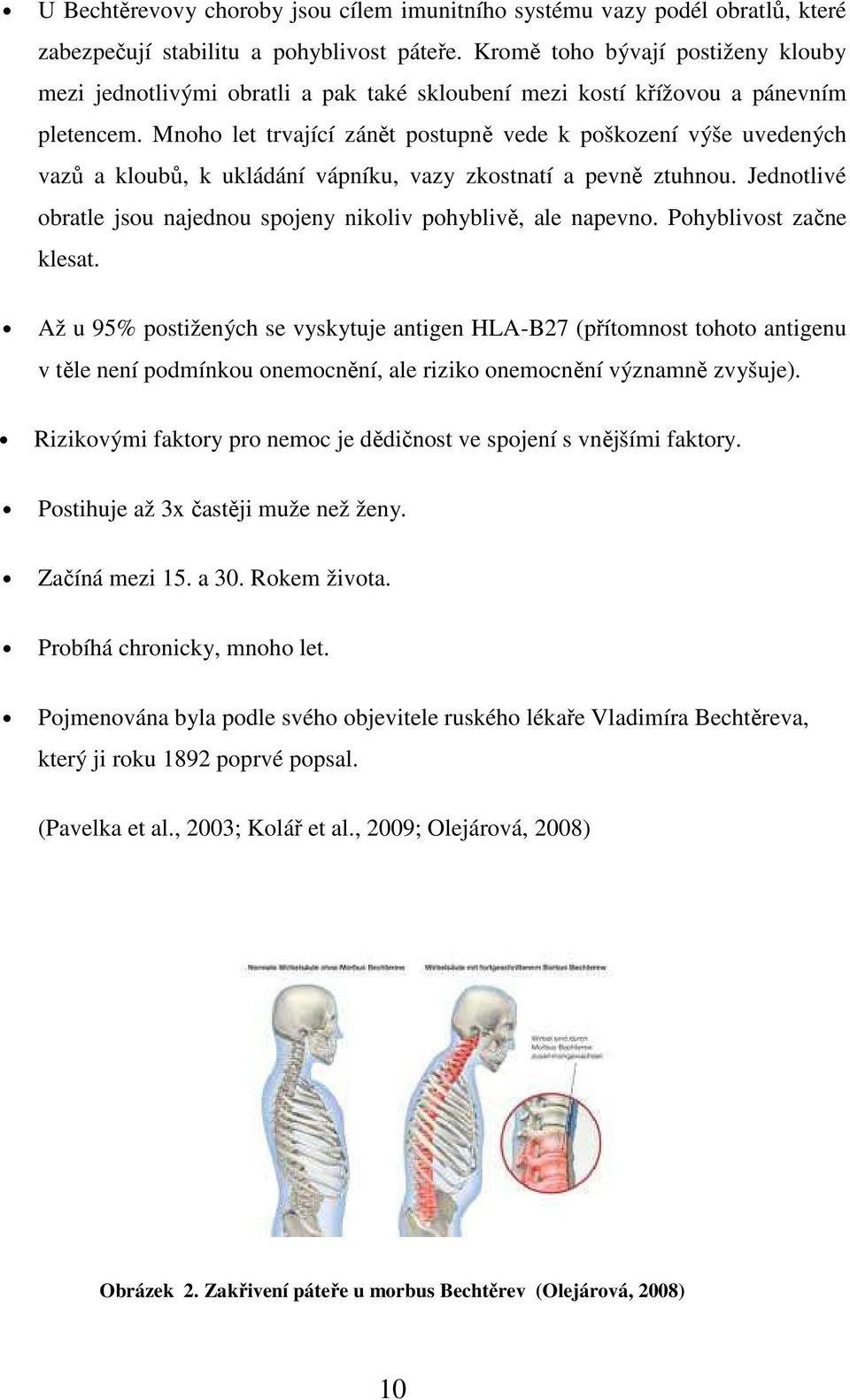 Mnoho let trvající zánět postupně vede k poškození výše uvedených vazů a kloubů, k ukládání vápníku, vazy zkostnatí a pevně ztuhnou.
