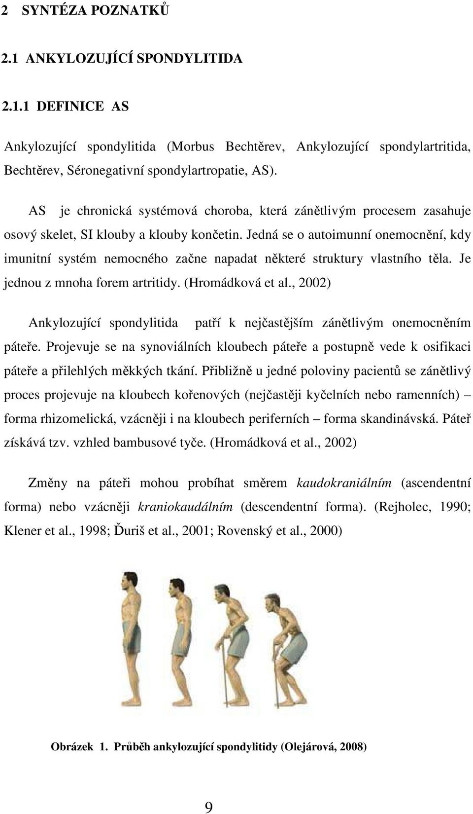 Jedná se o autoimunní onemocnění, kdy imunitní systém nemocného začne napadat některé struktury vlastního těla. Je jednou z mnoha forem artritidy. (Hromádková et al.