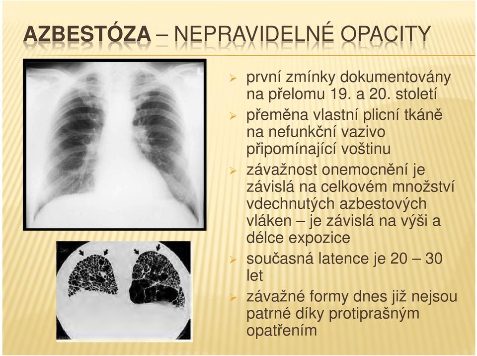 onemocnění je závislá na celkovém množství vdechnutých azbestových vláken je závislá na výši